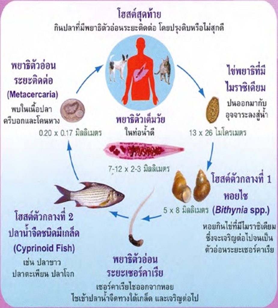 โรคพยาธ ใบไม ต บ Hospital For Tropical Diseases