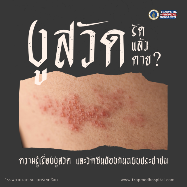 งูสวัด